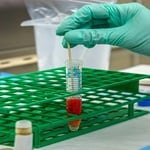 Public Health